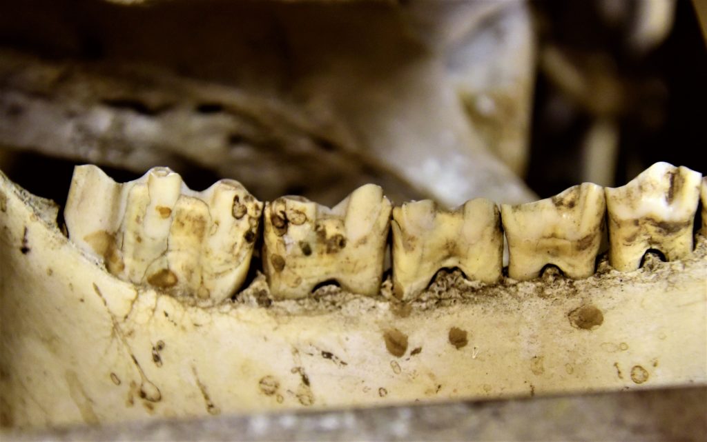 a jawbone with teeth